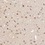 TXNL1 Antibody in Immunohistochemistry (Paraffin) (IHC (P))