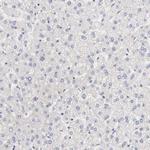 TXNL1 Antibody in Immunohistochemistry (Paraffin) (IHC (P))