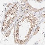 TXNL1 Antibody in Immunohistochemistry (Paraffin) (IHC (P))