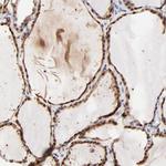 TXNL1 Antibody in Immunohistochemistry (Paraffin) (IHC (P))