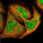 XTP3TPA Polyclonal Antibody