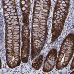 XTP3TPA Antibody in Immunohistochemistry (Paraffin) (IHC (P))