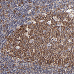 XTP3TPA Antibody in Immunohistochemistry (Paraffin) (IHC (P))