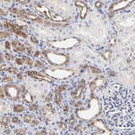 XTP3TPA Antibody in Immunohistochemistry (Paraffin) (IHC (P))