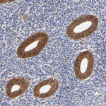 XTP3TPA Antibody in Immunohistochemistry (Paraffin) (IHC (P))