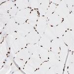 FBXO18 Antibody in Immunohistochemistry (Paraffin) (IHC (P))