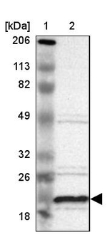 ALG13 Antibody in Western Blot (WB)