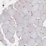 JM4 Antibody in Immunohistochemistry (IHC)