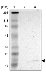 JM4 Antibody in Western Blot (WB)