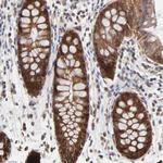 FRMD8 Antibody in Immunohistochemistry (Paraffin) (IHC (P))