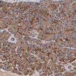 FRMD8 Polyclonal Antibody