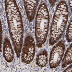 FRMD8 Antibody in Immunohistochemistry (Paraffin) (IHC (P))