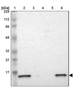 ATP5D Antibody in Western Blot (WB)