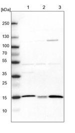 ATP5D Antibody in Western Blot (WB)