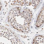 SSBP1 Antibody in Immunohistochemistry (IHC)