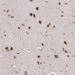 ABHD12B Antibody in Immunohistochemistry (Paraffin) (IHC (P))