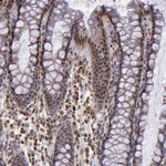 ABHD12B Antibody in Immunohistochemistry (Paraffin) (IHC (P))