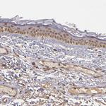 ABHD12B Antibody in Immunohistochemistry (Paraffin) (IHC (P))