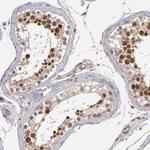 ABHD12B Polyclonal Antibody