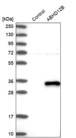 ABHD12B Antibody in Western Blot (WB)