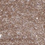 SIPA1L1 Antibody in Immunohistochemistry (Paraffin) (IHC (P))