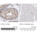 SIPA1L1 Antibody in Immunohistochemistry (Paraffin) (IHC (P))