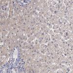 SIPA1L1 Antibody in Immunohistochemistry (Paraffin) (IHC (P))