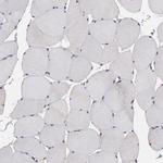 SIPA1L1 Antibody in Immunohistochemistry (Paraffin) (IHC (P))