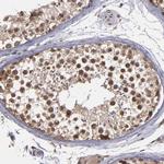 SIPA1L1 Antibody in Immunohistochemistry (Paraffin) (IHC (P))