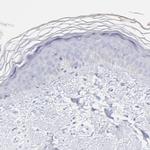 S100A12 Antibody in Immunohistochemistry (Paraffin) (IHC (P))