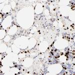 S100A12 Antibody in Immunohistochemistry (IHC)