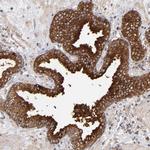 MIPOL1 Antibody in Immunohistochemistry (Paraffin) (IHC (P))