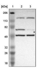 MIPOL1 Antibody in Western Blot (WB)