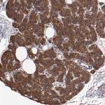 DNAAF2 Polyclonal Antibody