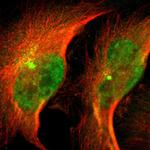 NDRG2 Polyclonal Antibody