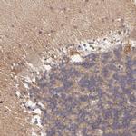 ZFYVE1 Antibody in Immunohistochemistry (Paraffin) (IHC (P))