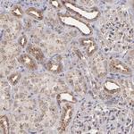 ZFYVE1 Antibody in Immunohistochemistry (Paraffin) (IHC (P))