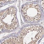 ZFYVE1 Antibody in Immunohistochemistry (Paraffin) (IHC (P))