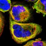 ZFYVE1 Antibody in Immunocytochemistry (ICC/IF)
