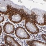 EXD2 Polyclonal Antibody