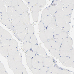 AADAC Antibody in Immunohistochemistry (Paraffin) (IHC (P))
