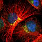 EAPP Polyclonal Antibody