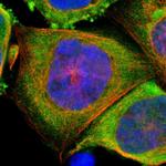 PSMD10 Polyclonal Antibody