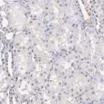 PSMD10 Antibody in Immunohistochemistry (Paraffin) (IHC (P))