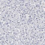 PSMD10 Antibody in Immunohistochemistry (Paraffin) (IHC (P))
