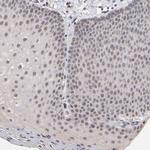 PSMD10 Antibody in Immunohistochemistry (Paraffin) (IHC (P))