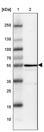 ENTPD5 Antibody in Western Blot (WB)