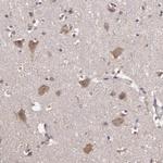 HECTD1 Antibody in Immunohistochemistry (Paraffin) (IHC (P))