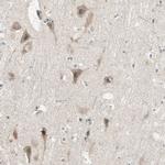 CGRRF1 Antibody in Immunohistochemistry (Paraffin) (IHC (P))