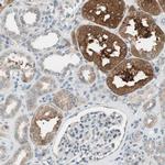 CGRRF1 Antibody in Immunohistochemistry (Paraffin) (IHC (P))